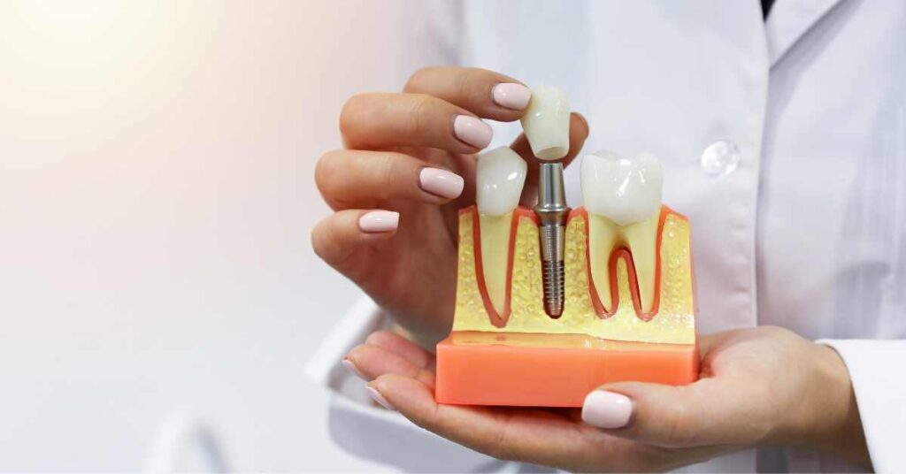 Dental Implant Shopping Online