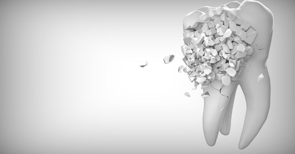 Comparing Dental Implant Costs Online: What to Expect